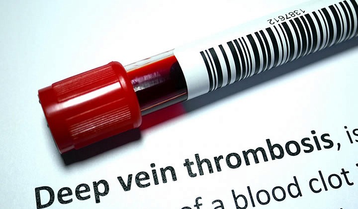 Specialist cancer service launches in Stoke-on-Trent