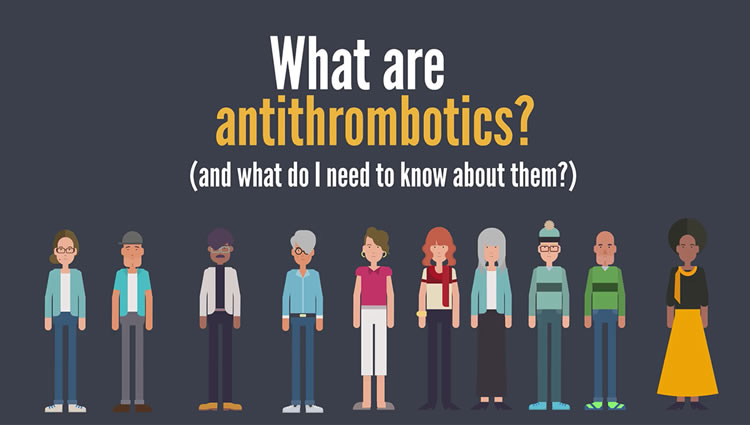 An introduction to anticoagulation